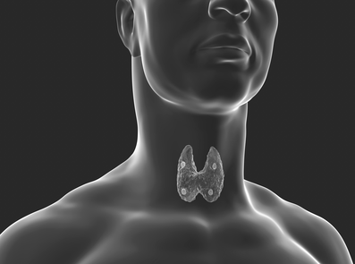 Normocalcemic Primary Hyperparathyroidism: A Cross-Sectional Study