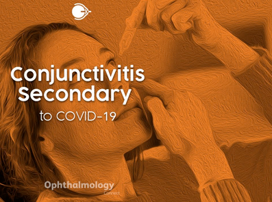 COVID-19: Ophthalmic Prophylactic and therapeutic measures